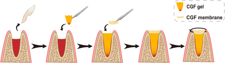 FIG. 4.