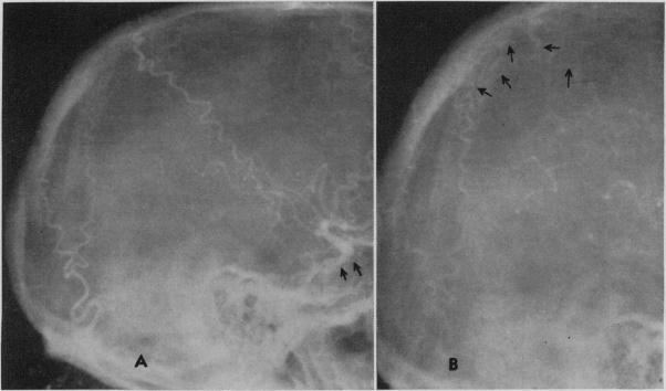 Fig. 12