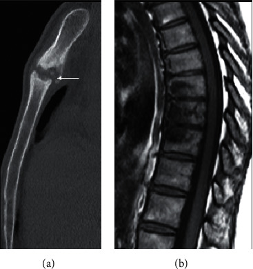 Figure 16