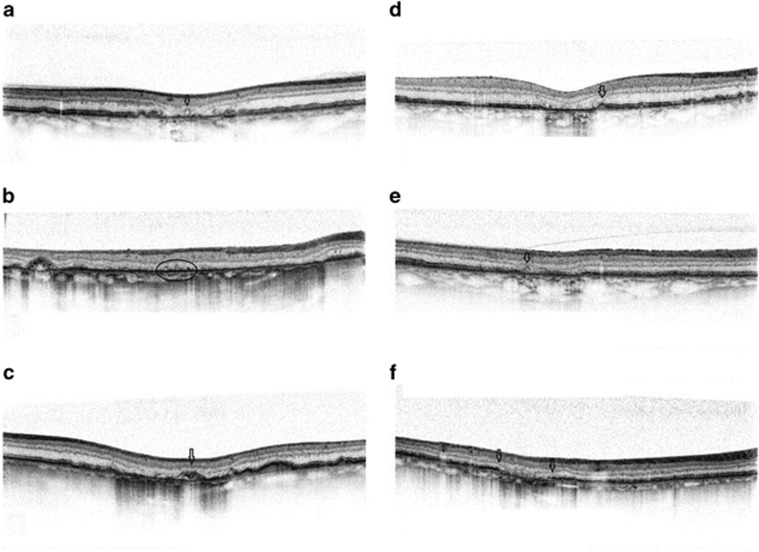 Figure 9