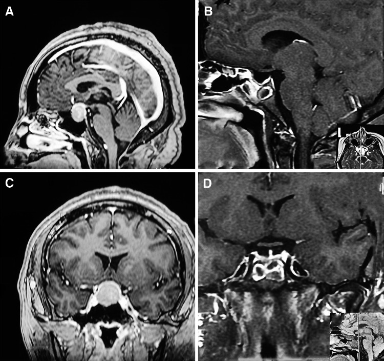 Fig. 4