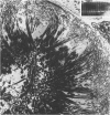 200