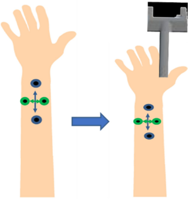 Fig. 11