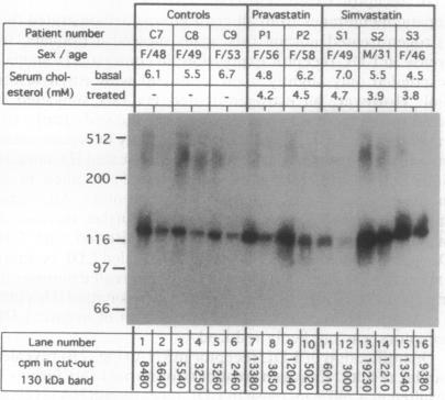 graphic file with name pnas01089-0333-b.jpg