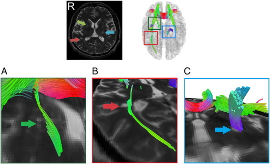 Fig. 10