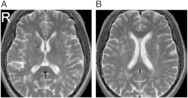 Fig. S4