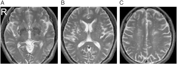 Fig. S3