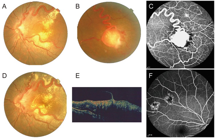 Fig. 2