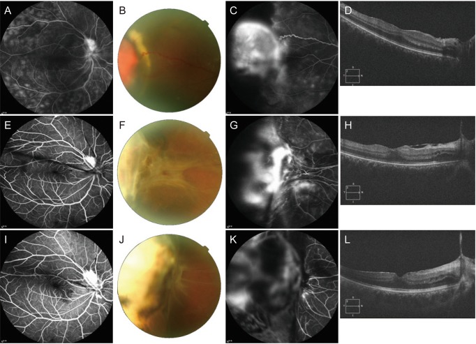 Fig. 4