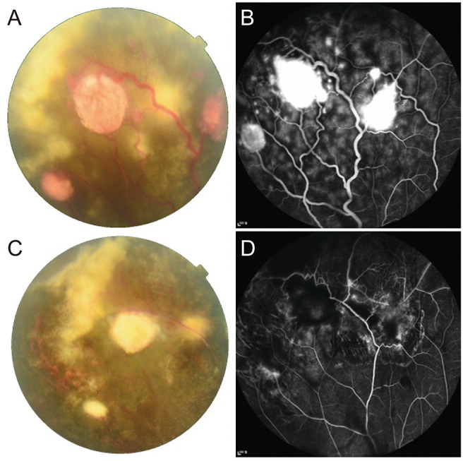 Fig. 1