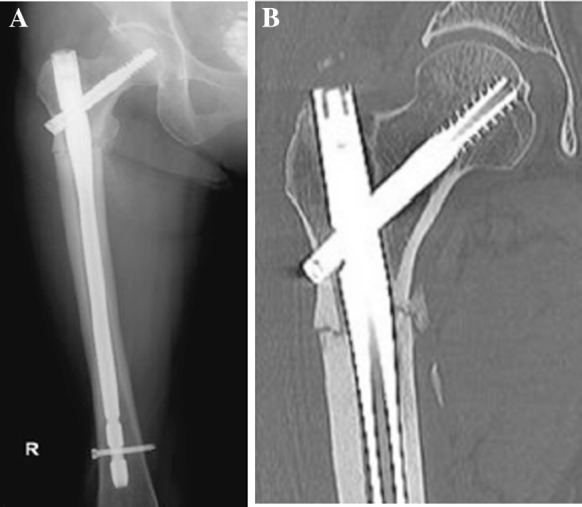 Fig. 3