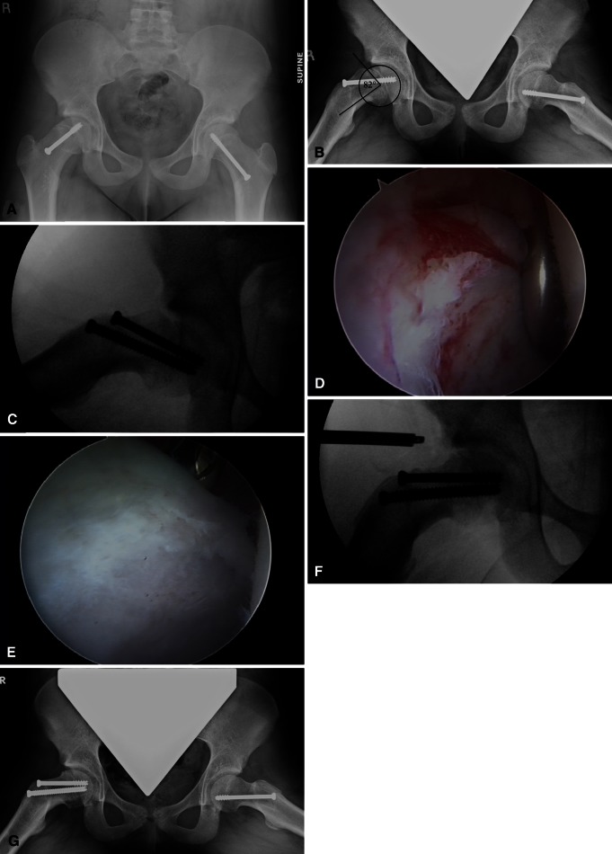 Fig. 3A–G