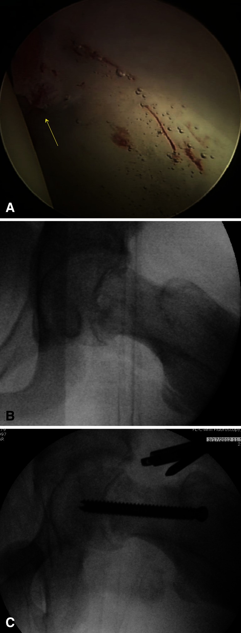 Fig. 5A–C