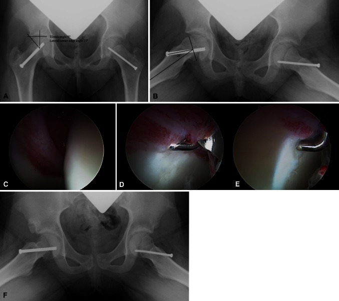 Fig. 1A–F