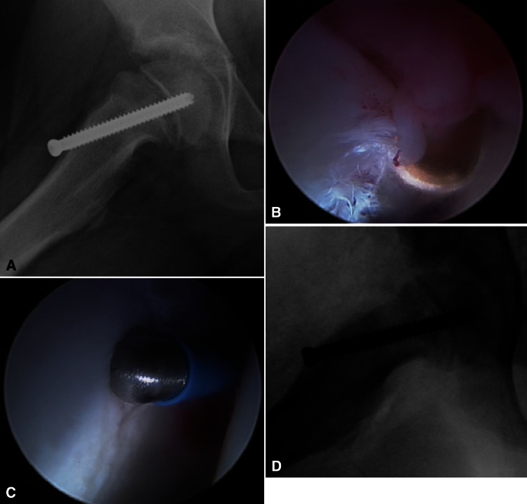 Fig. 2A–D