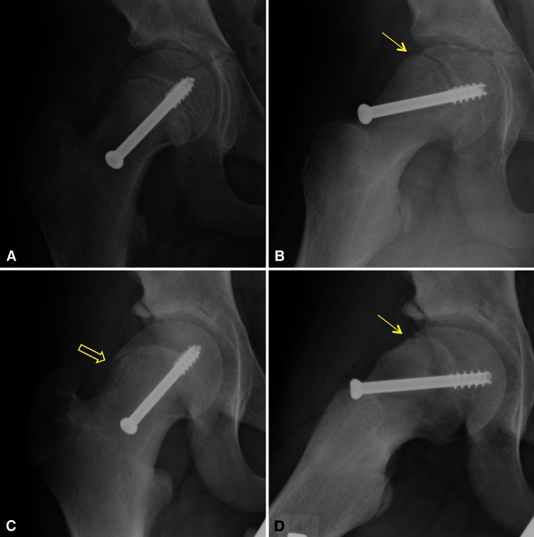 Fig. 6A–D