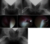 Fig. 1A–F