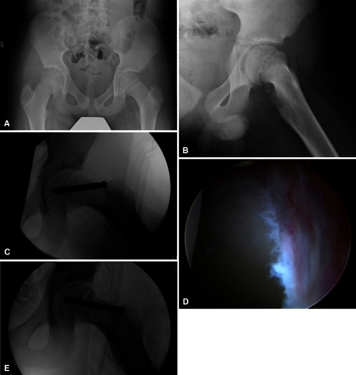 Fig. 4A–E