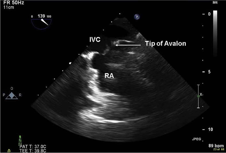 Figure 3