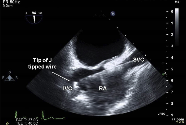 Figure 2