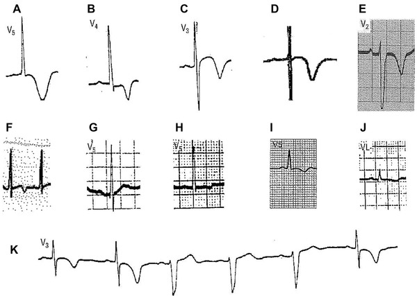 Figure 16