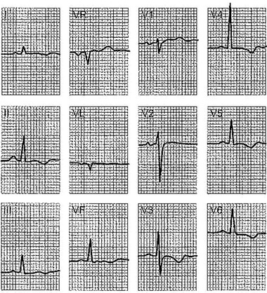 Figure 17