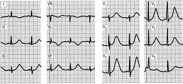 Figure 19