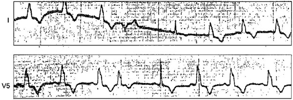 Figure 20