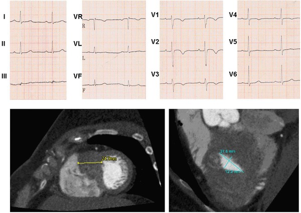 Figure 18