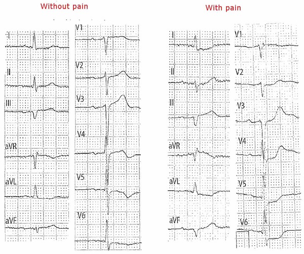 Figure 14