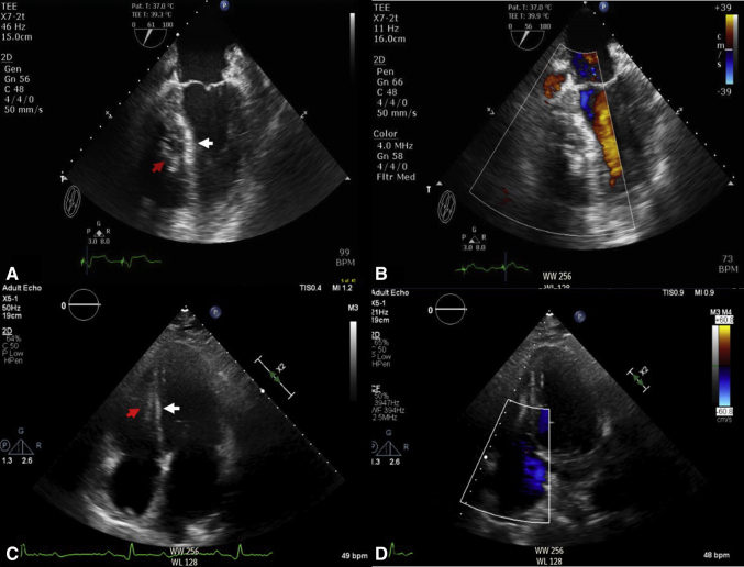 Figure 2