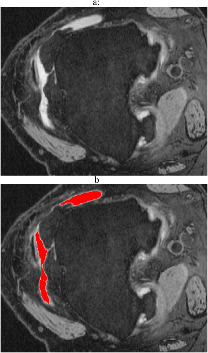 Fig. 1