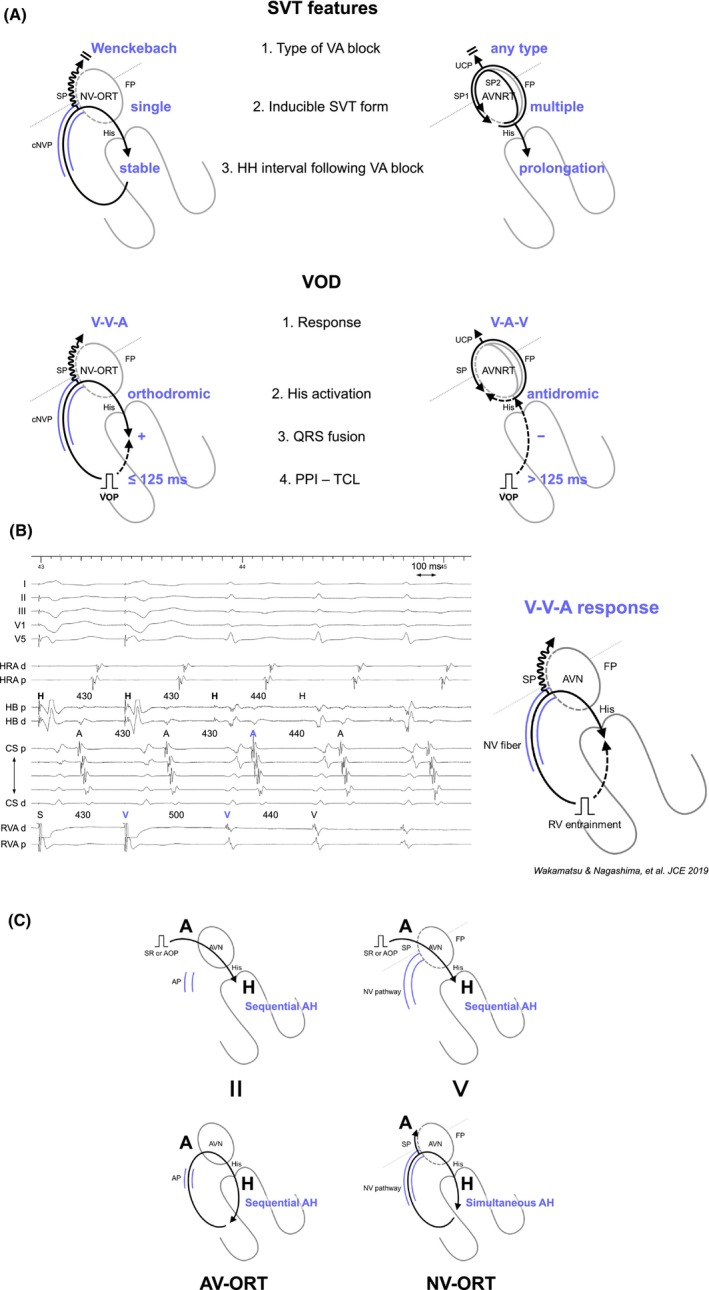 FIGURE 11