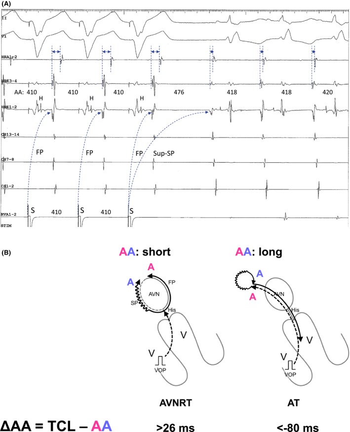 FIGURE 3