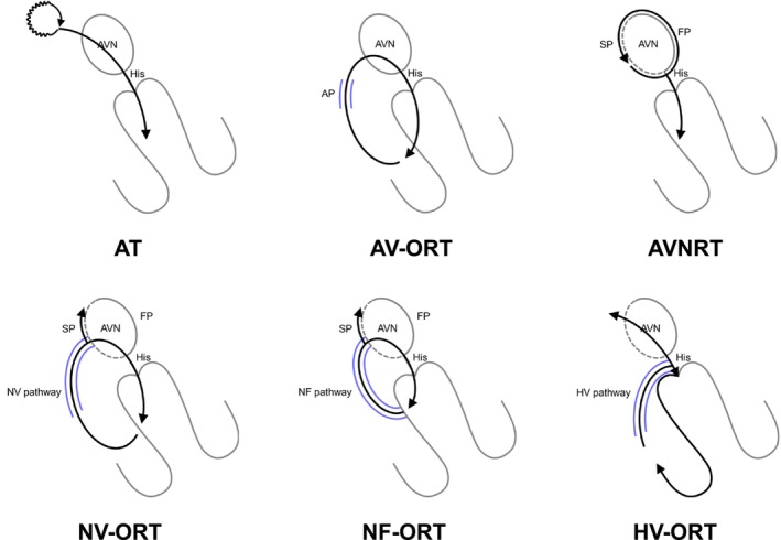 FIGURE 1