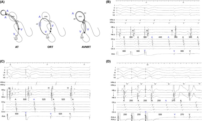 FIGURE 2