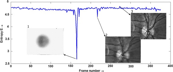 Fig. 2