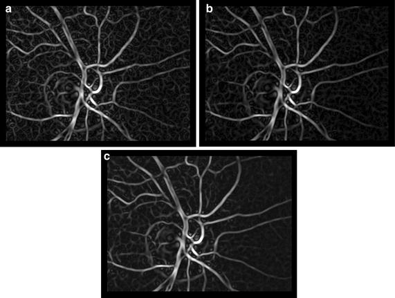 Fig. 5