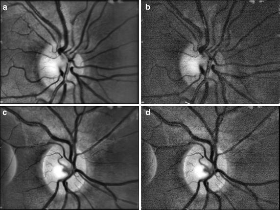 Fig. 9