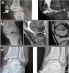 Fig. 2
