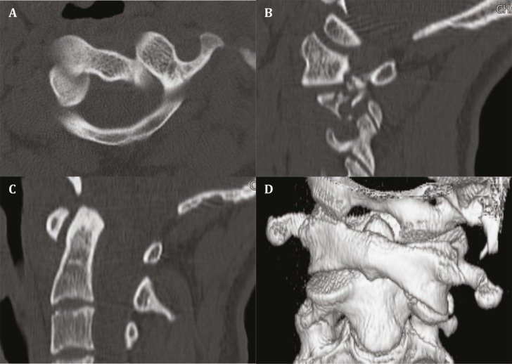 Fig.1