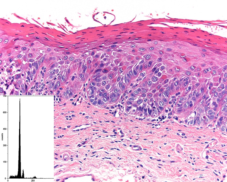 Fig. 2