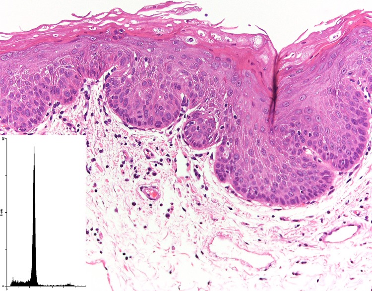 Fig. 1