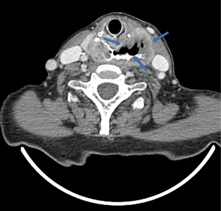 Figure 12