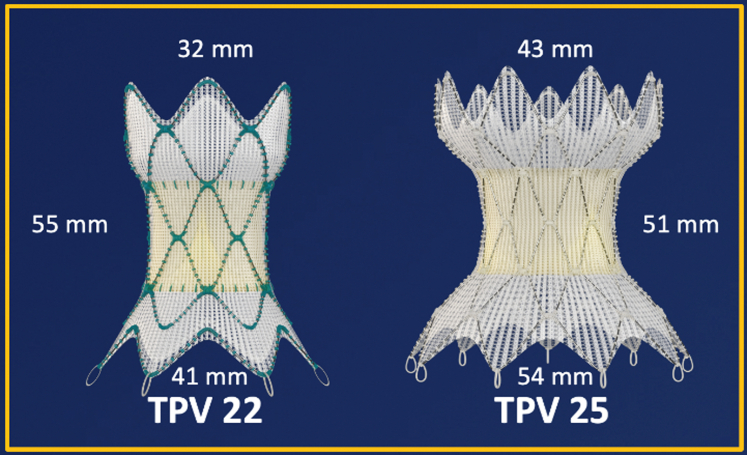 Figure 4