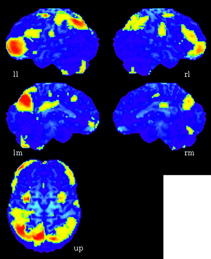 Fig 2.