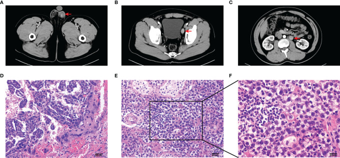 Figure 1