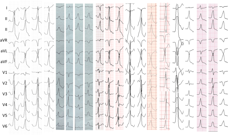 Figure 1