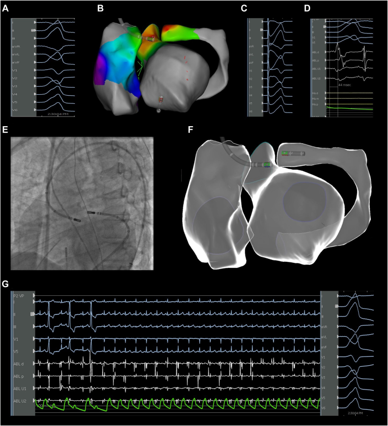 Figure 3