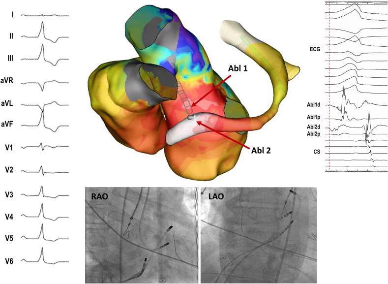 Figure 2